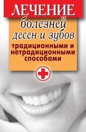 Лечение болезней десен и зубов традиционными и нетрадиционными способами - Drongelen Wim Van